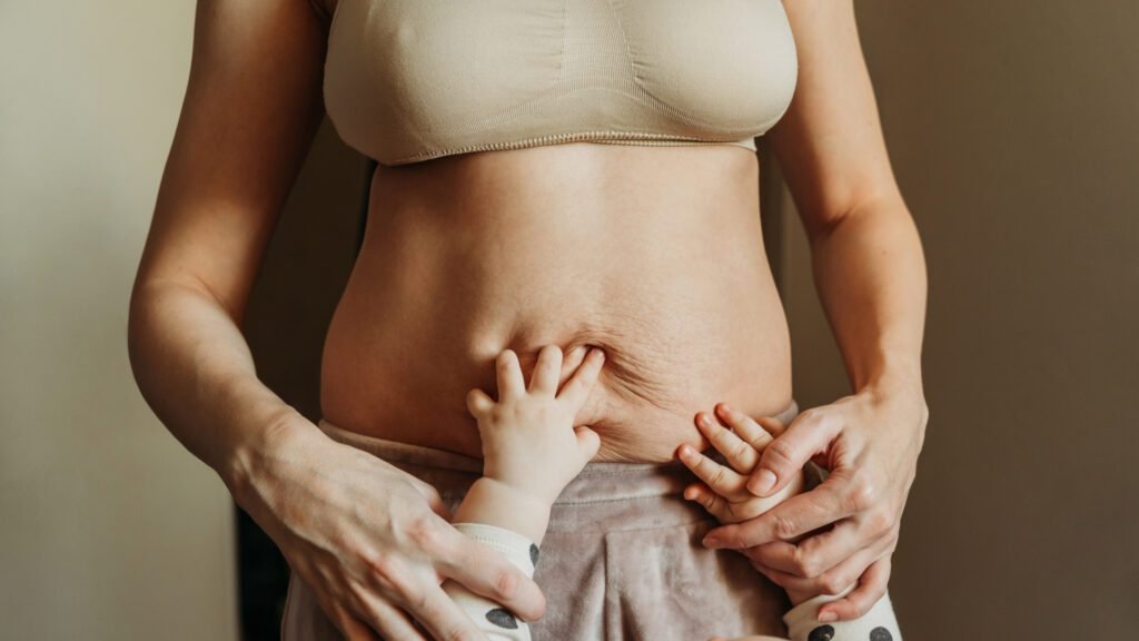 Mommy makeover transformation results, body contouring Dubai