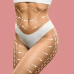 A-womans-body-with-lines-drawn-to-show-contouring-1024×627