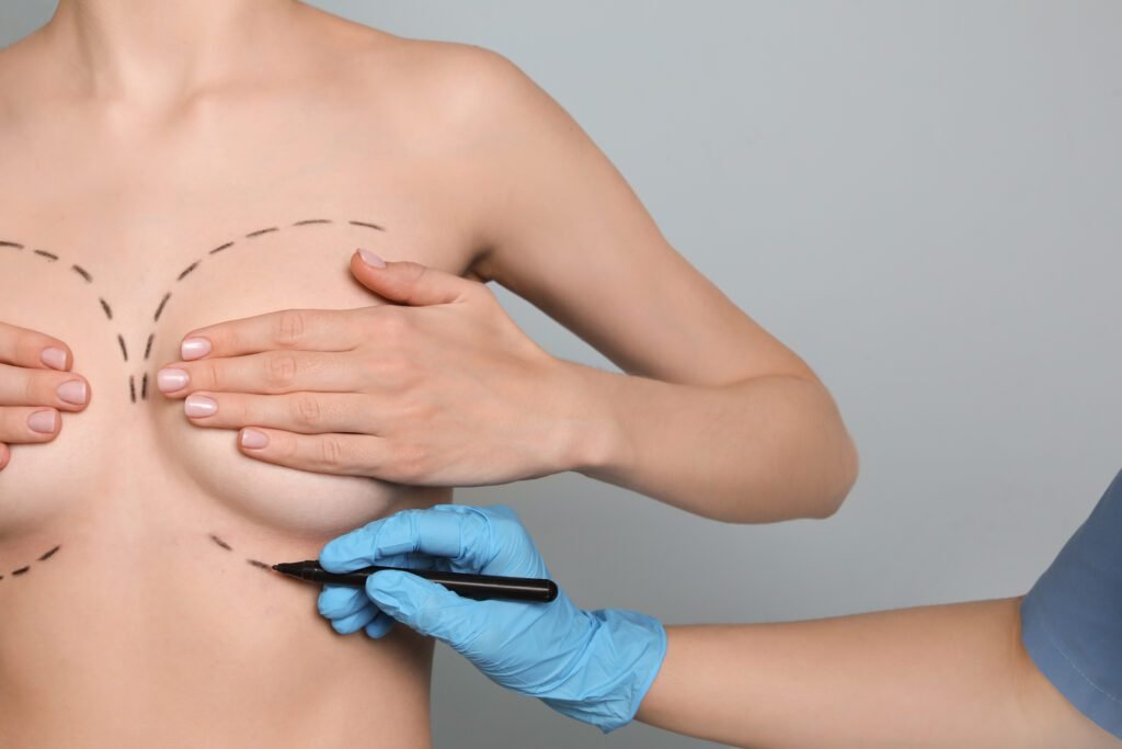 Doctor drawing marks on female breast for cosmetic surgery operation against color background - Cocoona Plastic Surgery Dubai