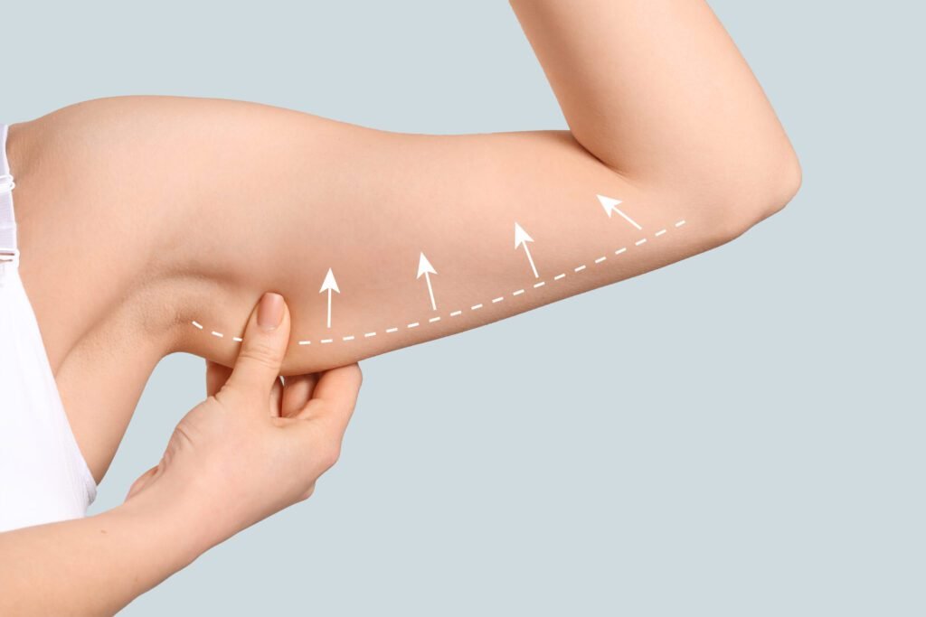Arm lift brachioplasty procedure and results Dubai