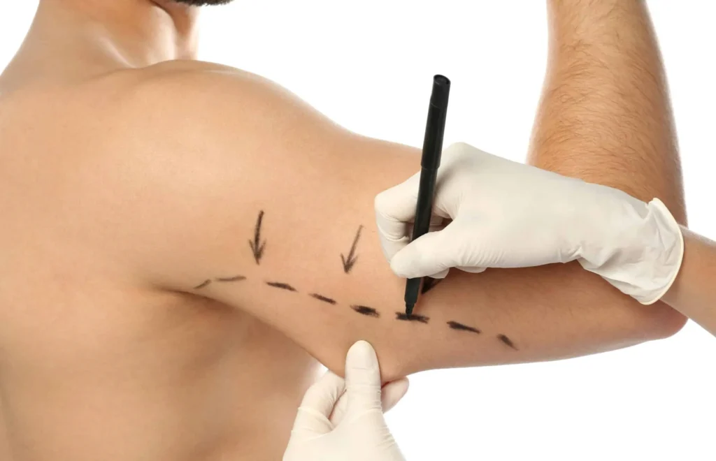 Arm-lift-In-Islamabad