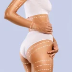 Body contouring after weight loss, excess skin removal guide Dubai