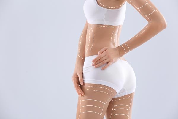 Body-copy