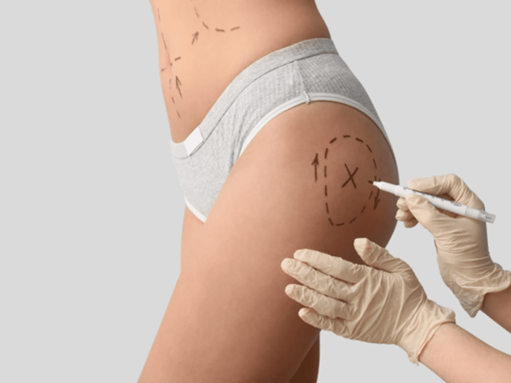Brazilian butt lift cost breakdown and pricing guide Dubai