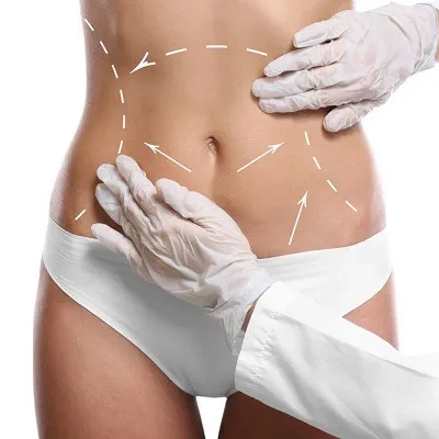 Liposuction in Dubai Abu Dhabi Best Liposuction Surgeons AED 7399 - Cocoona Plastic Surgery Dubai