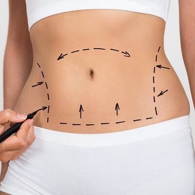 Liposuction in Dubai Abu Dhabi Royal Clinic Dubai - Cocoona Plastic Surgery Dubai