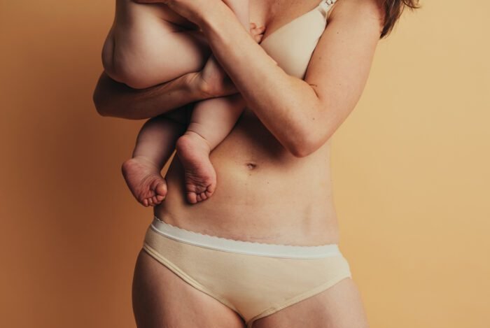 RS_NonInvasiveMommyMakeover-1-700x504