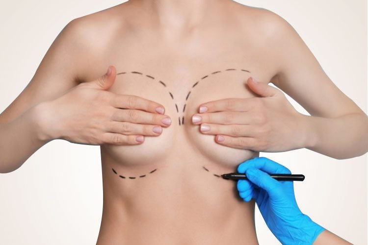 breast augmentation - Cocoona Plastic Surgery Dubai