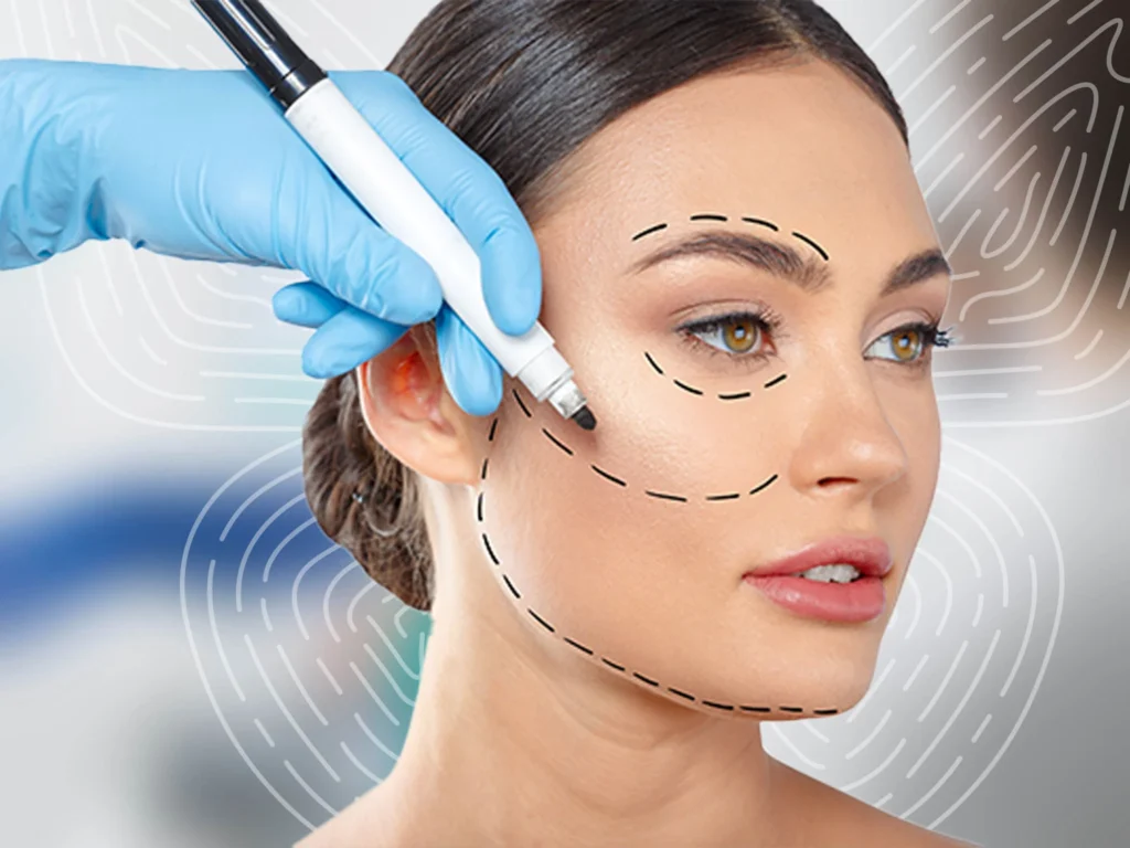 Facelift surgery results and facial rejuvenation Dubai