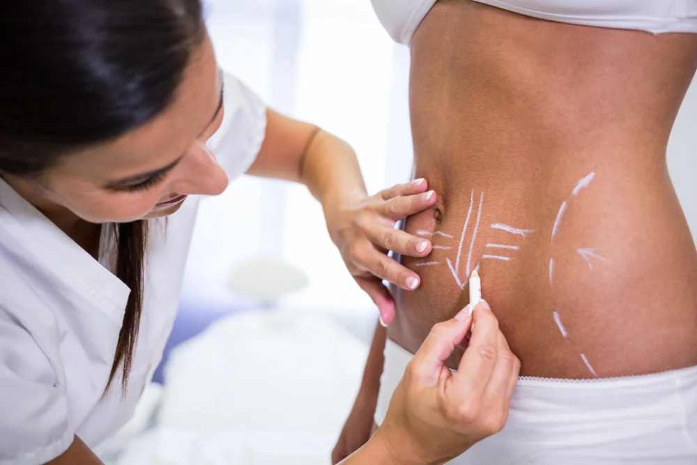 Tummy Tuck Price UAE - Cocoona Plastic Surgery Dubai