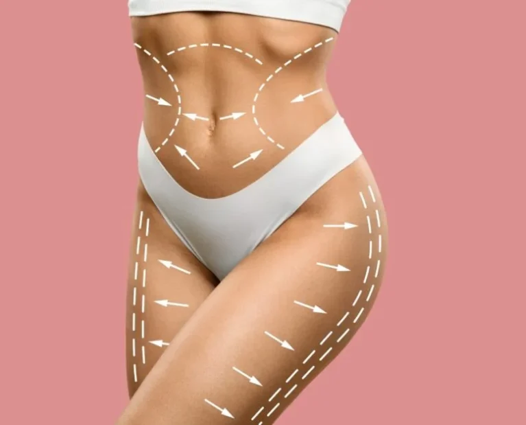 A-womans-body-with-lines-drawn-to-show-contouring-1024x627