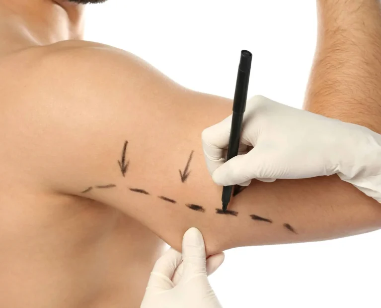 Arm-lift-In-Islamabad