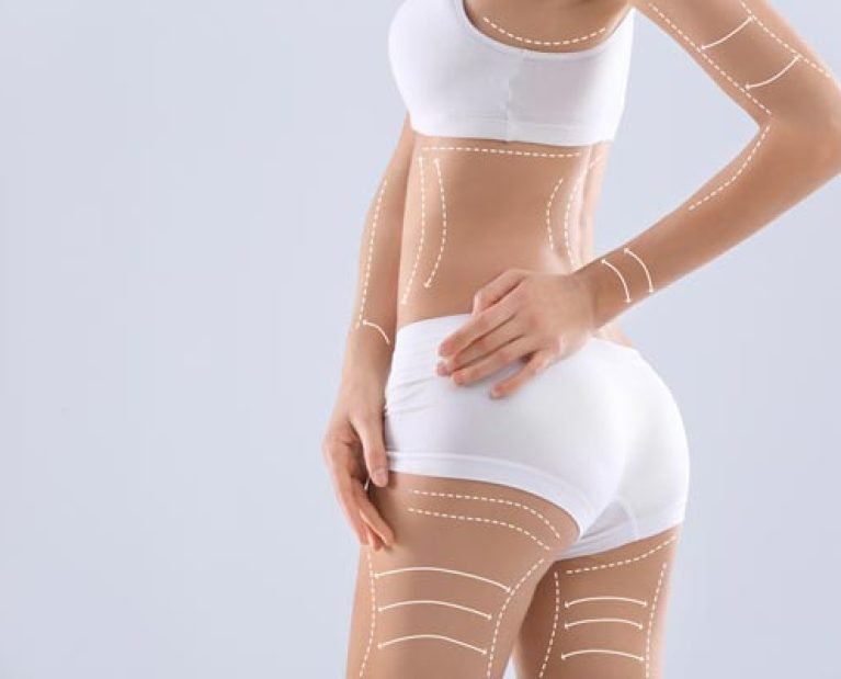 Body-copy