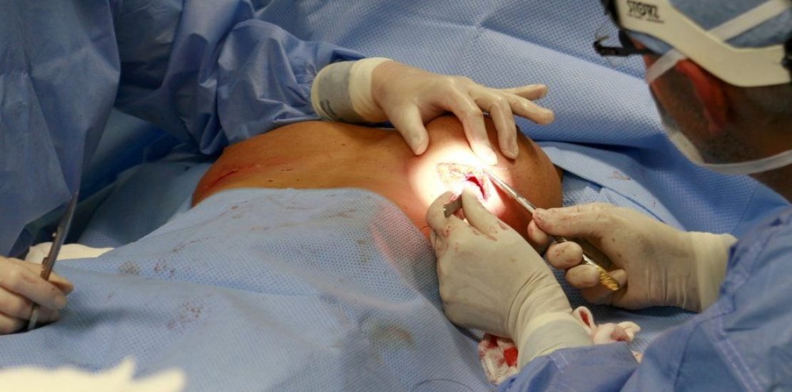 Breast-Surgery-for-Older-Women-a6a120a4