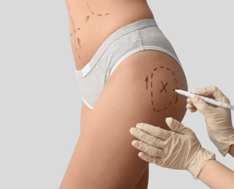 Brazilian butt lift cost breakdown and pricing guide Dubai