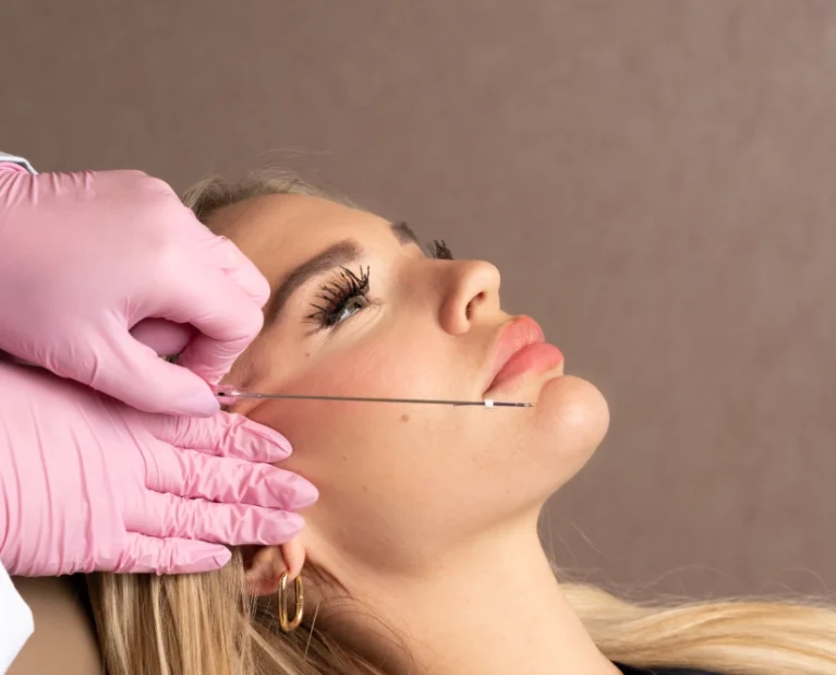 What-Are-the-Primary-Benefits-of-PDO-Thread-Lift-for-Individuals-Seeking-Non-Surgical-Facial-Rejuvenation_