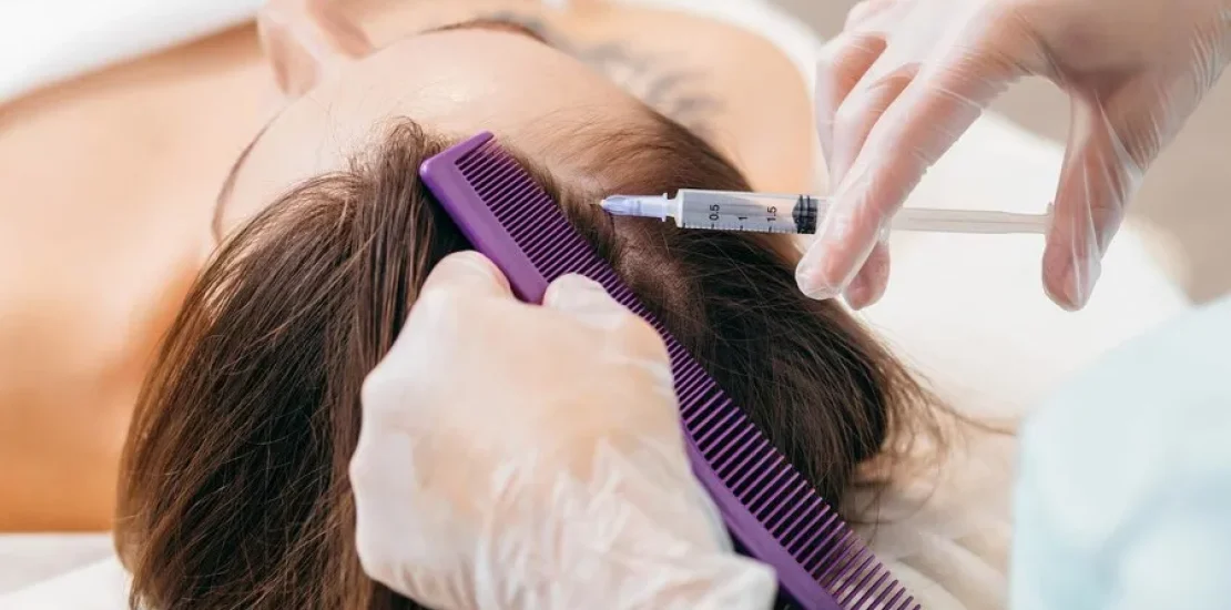 blog-featured-hair-loss-in-women