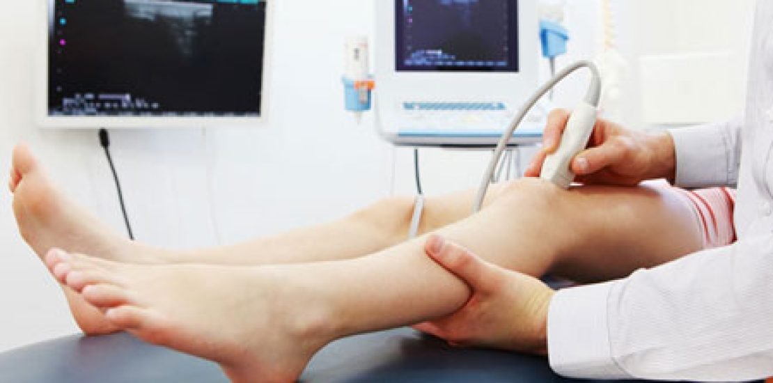 deep-vein-thrombosis3