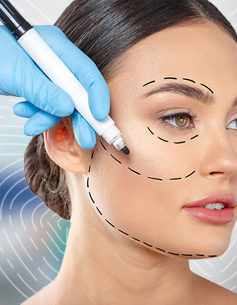 Facelift surgery results and facial rejuvenation Dubai