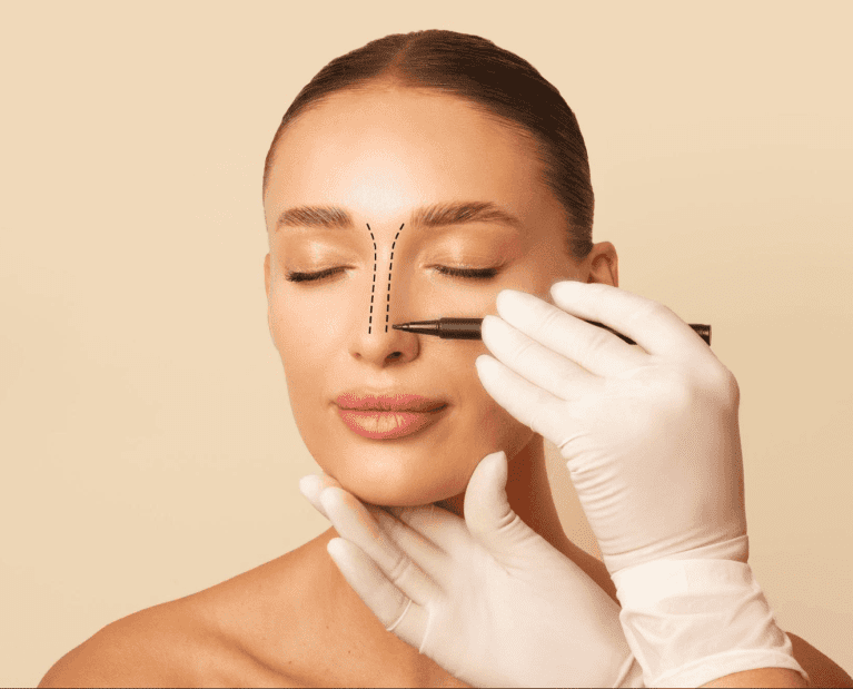 Rhinoplasty before and after nose reshaping results Dubai