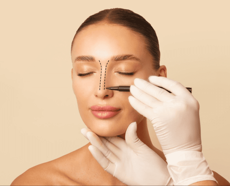 Rhinoplasty before and after nose reshaping results Dubai
