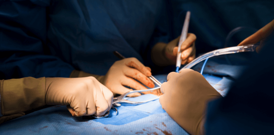 surgical-site-infection