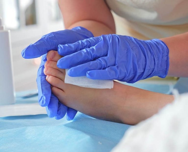 Wound treatment and professional wound care services Dubai